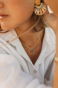 NOA